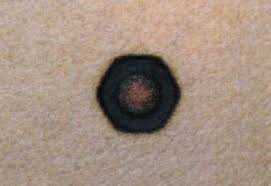 جلوگیری از جرقه و الکتریسیته ساکن 